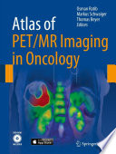 Atlas of PET/MR imaging in oncology