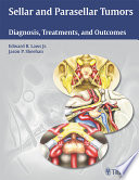 Sellar and parasellar tumors : diagnosis, treatments, and outcomes /