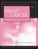 Breast cancer /