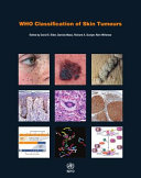 WHO classification of skin tumours /