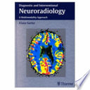 Diagnostic and interventional neuroradiology : a multimodality approach /