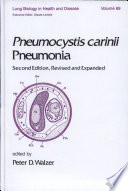 Pneumocystis carinii pneumonia /