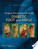 Surgical reconstruction of the diabetic foot and ankle /