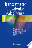 Transcatheter paravalvular leak closure /