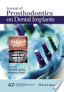 Journal of prosthodontics on dental implants /