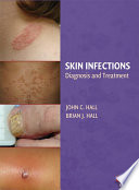 Skin infections : diagnosis and treatment /