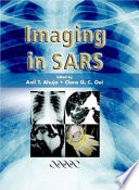 Imaging in SARS /