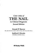 Color atlas of the nail in clinical diagnosis /