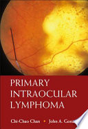 Primary intraocular lymphoma /