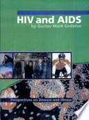 HIV and AIDS /