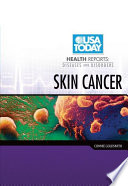 Skin cancer /