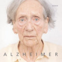 Alzheimer /