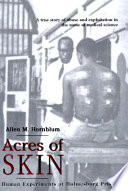 Acres of skin : human experiments at Holmesburg Prison : a story of abuse and exploitation in the name of medical science /
