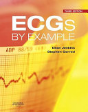 ECGs by example /