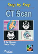 CT scan /