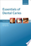Essentials of dental caries /