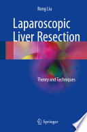 Laparoscopic liver resection : theory and techniques /