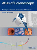 Atlas of colonoscopy : yechniques, diagnosis, interventional procedures /