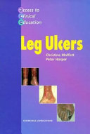 Leg ulcers /