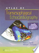 Atlas of transesophageal echocardiography /