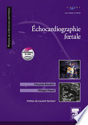 Echocardiographie fœtale.