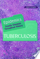 Tuberculosis /