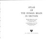 Atlas of the human brain in section