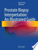 Prostate biopsy interpretation an illustrated guide /