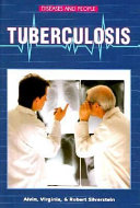 Tuberculosis /