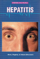 Hepatitis /