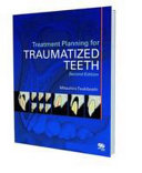 Treatment planning for traumatized teeth /