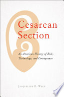 Cesarean section : an American history of risk, technology, and consequence /